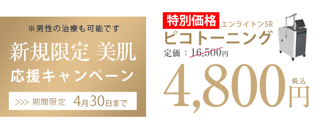 シミ・そばかすの治療が安くなるキャンペーン