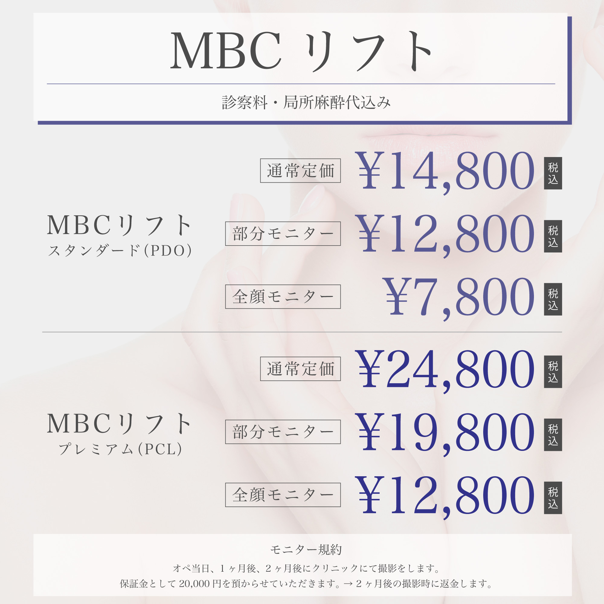 MBCスレッドリフト価格表