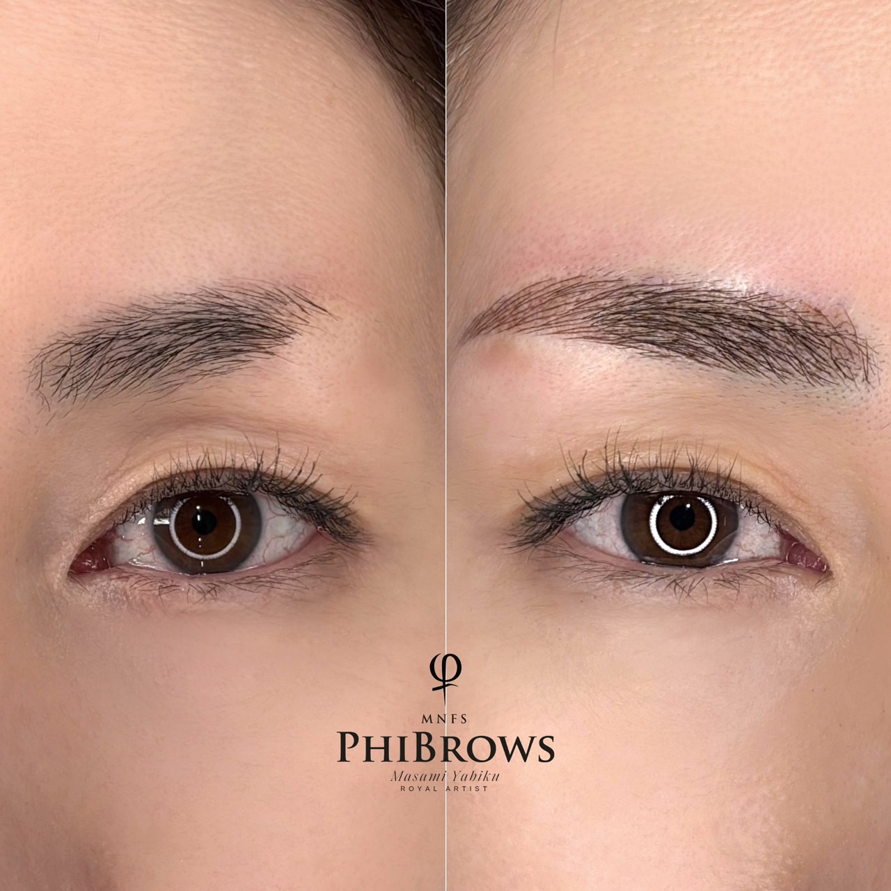 屋比久 眉アートメイク症例2