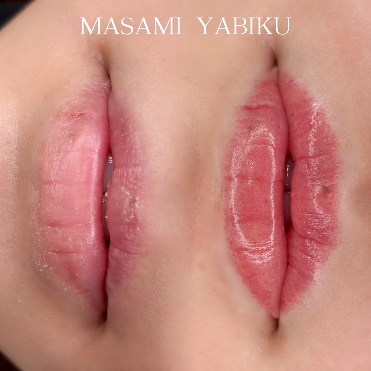 屋比久 リップアートメイク症例2