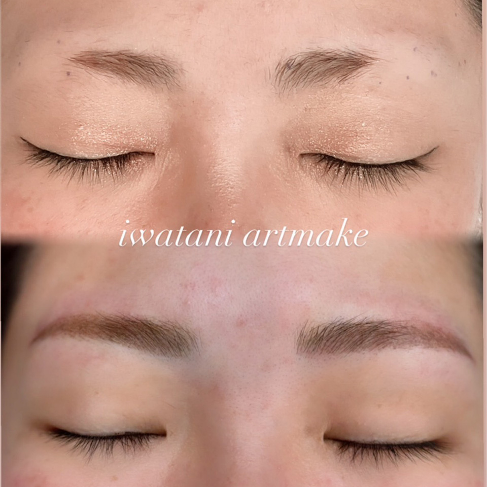 岩谷 眉アートメイク症例3