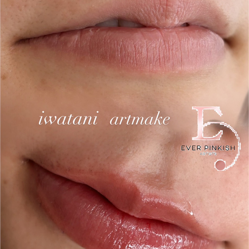 岩谷 リップアートメイク症例1