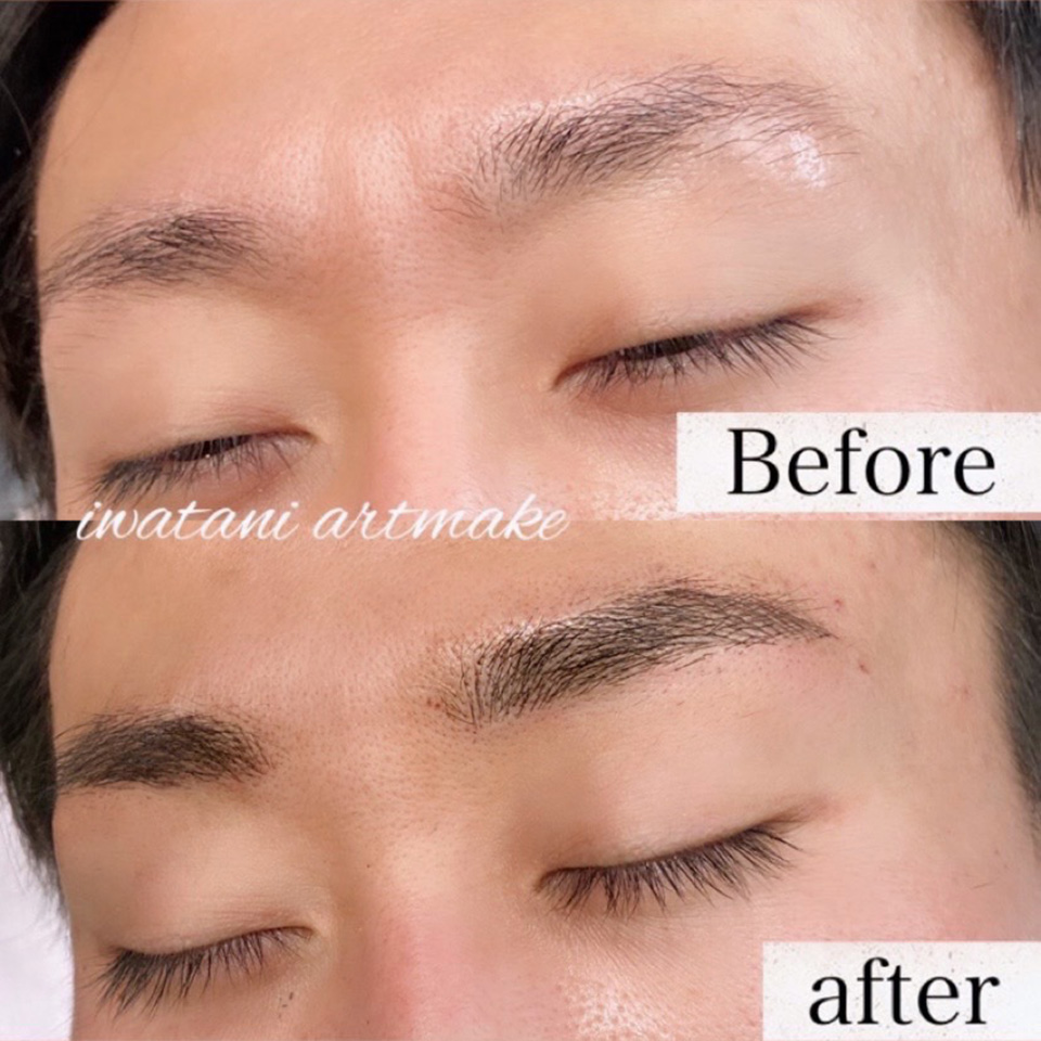 岩谷 メンズアートメイク症例1