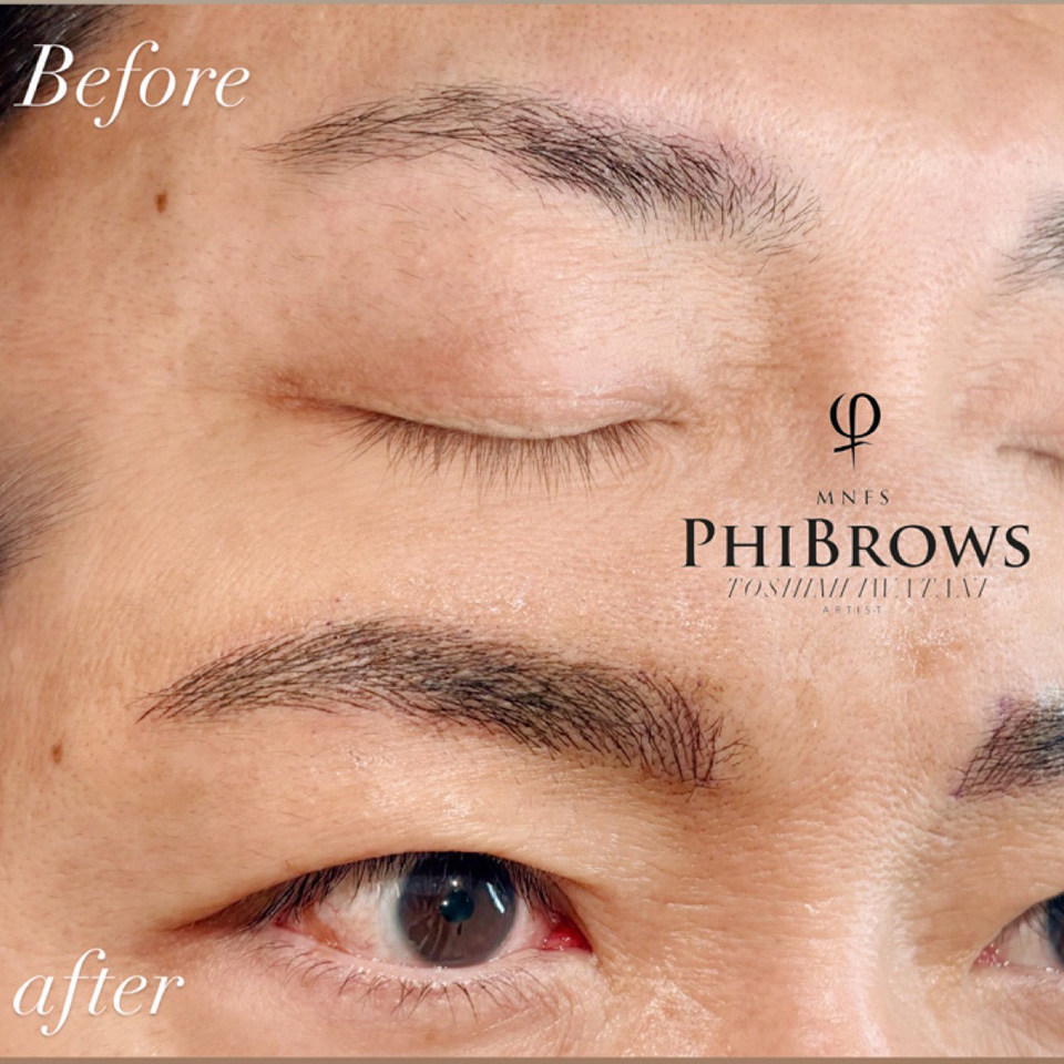 岩谷 メンズアートメイク症例2