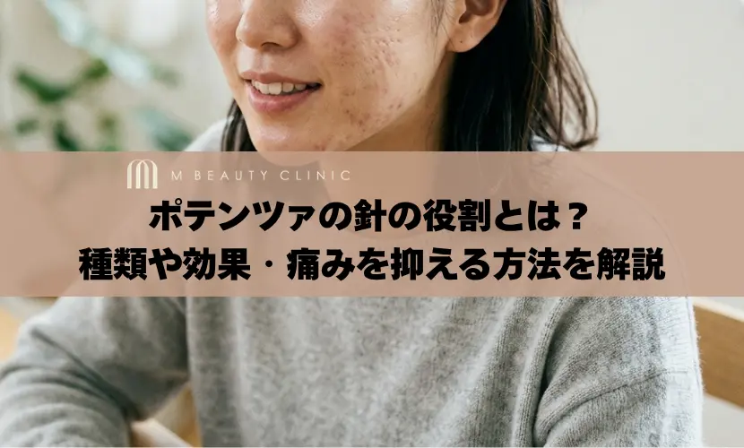 ポテンツァの針の役割とは？種類や効果・痛みを抑える方法を解説